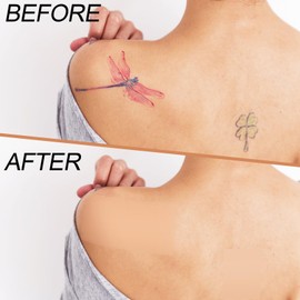 AFGHOUZ 6 PCS Body Concealer Makeup Patch, Cover up Patch Waterproof, Second Skin Cover up Tape, Body Coverage Perfector