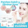 Parches Faciales Antiacné Universo en Linea Hipoalergénicos 25 Piezas