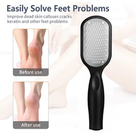 Amaezorx 1Pcs Professional Foot File Callus Remover with Dead Skin Catcher - Mess-Free Pedicure Tool for Cracked Heels, Wet & Dry Use Foot Scrubber & Heel Rasp - Durable & Hygienic (Black)