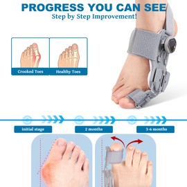 Hallux Valgus Korrektur Set – Verstellbare Schiene mit Drehknopf, Silikon Zehenspreizer & Trainingsband, Universalgröße Bunion Schiene für Tag & Nacht, Ballenzeh Korrektor Damen & Herren