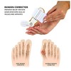 PEDIMEND™ Bunion Splint with Adjustable Strap (1PCS) - Bunion Aid