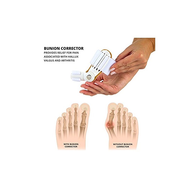 PEDIMEND™ Bunion Splint with Adjustable Strap (1PCS) - Bunion Aid