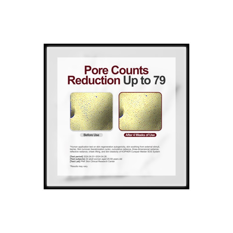 Kopher [Kopher]Curepair Melder SOS System 1.5ml (20ea)