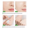 Duo Crema Aclarante Zonas Intimas Perianal Entrepierna Axila