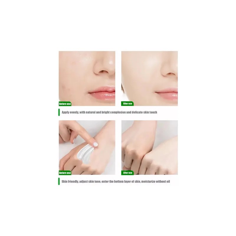 Duo Crema Aclarante Zonas Intimas Perianal Entrepierna Axila