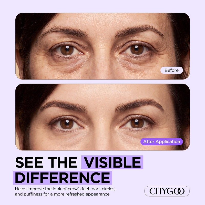 Instant Lift Eye Gel: Eye Firming Cream for Under Eye