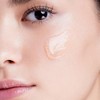 Top-Rated Cream for Dark Spots and Melasma - Bifida Ferment