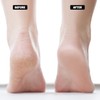 Moisturizing Socks Lotion Gel for Dry Cracked Heels 4 Pack,