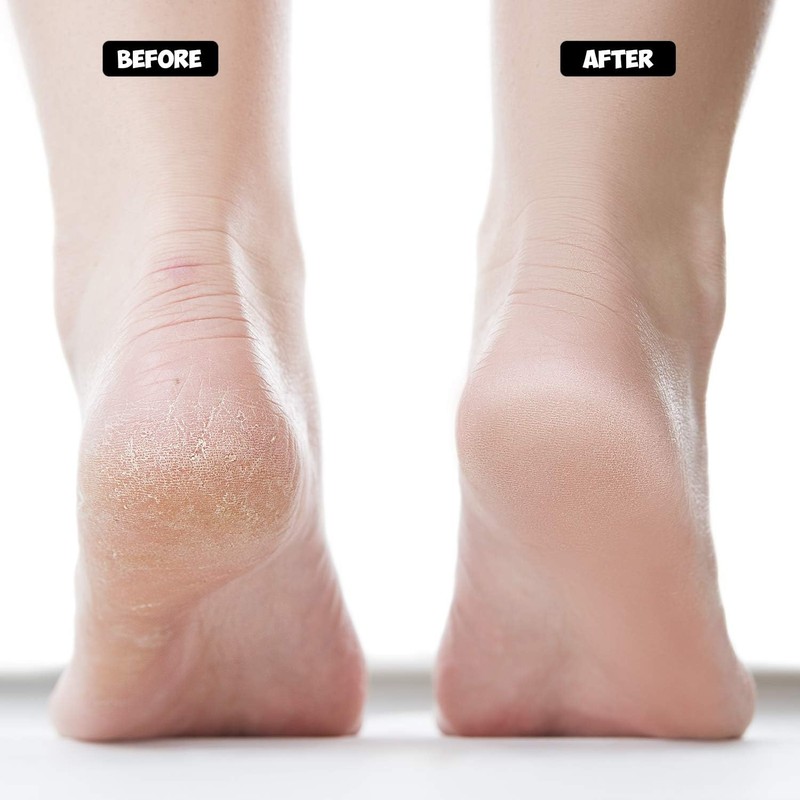 Moisturizing Socks Lotion Gel for Dry Cracked Heels 4 Pack,