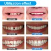 Temporary Teeth Repair Kit - Teeth replacement kit for temporary