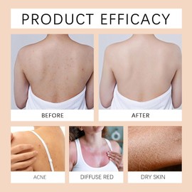 Aceite corporal antiedad, aceite corporal con complejo multipéptido para reafirmar la piel, 60ml Ac/eite corpo/ral reafirmante multipéptido de rápida absorción, ligero y de rápida absorción (4 PCS)