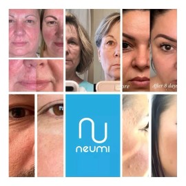 Botella Antioxidante y vitaminas Neumi Neumi Neumi Skin día/noche para todo tipo de piel de 100mL