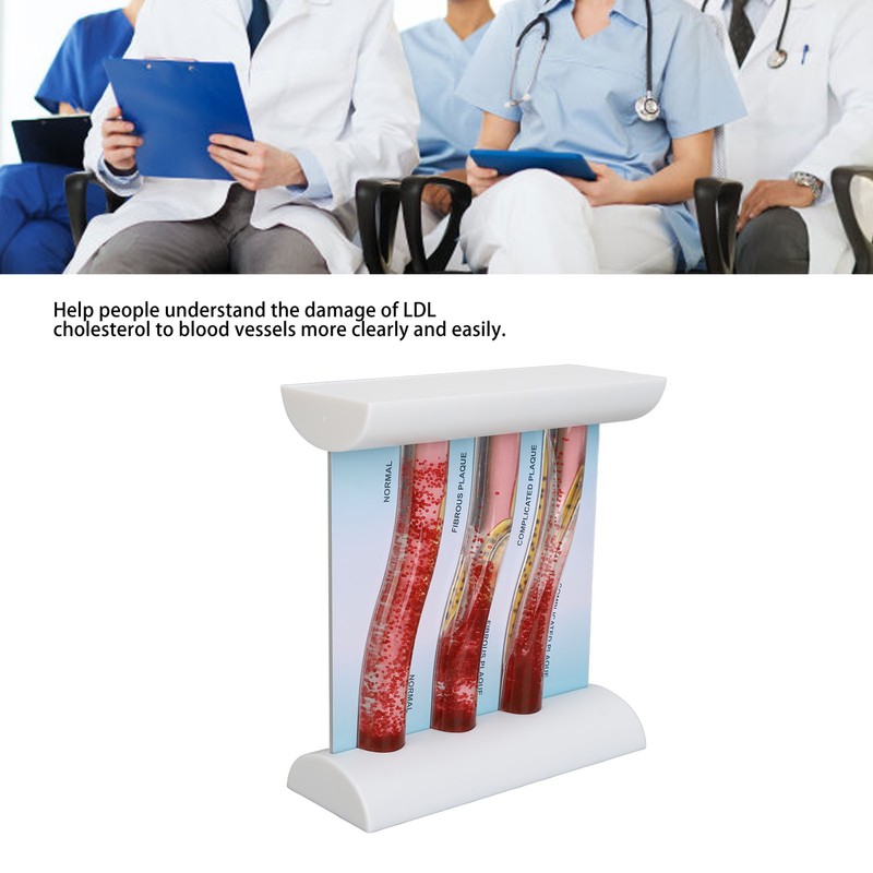 Lipoprotein LDL Blood Vessel Model Low Density Blood Lipid Vessel
