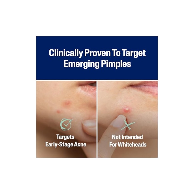 Cetaphil Cetaphil Acne Patches, Pimple Patches for Sensitive Skin, Formulated