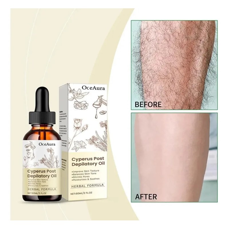 Aceite Inhibidor Del Cabello, 60 Ml, De Rápida Absorción, No