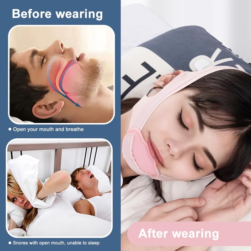 FDEETY Anti Snoring Chin Strap Prevent Snoring Stopper Sleep Apnea