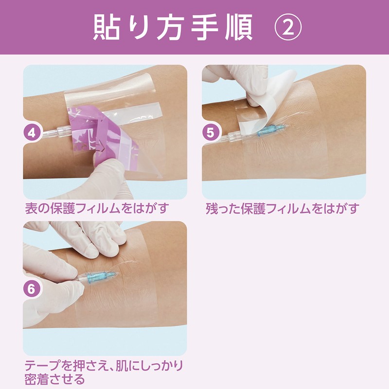 Fill Fix, 20 (Film Dressing) 80 X 100 mm, 50 Pieces/7 – 3297 – 03 