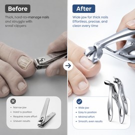 Wide Jaw Toenail Clippers for Thick Nails – Long Handle Stainless Steel Cutter for Home Manicure & Pedicure Care