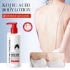 Skin Whitening Body Lotion with Kojic Acid, Kojic Acid Brightening