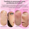 7.0 + TXA 4.0.CREAM Crema de manchas faciales