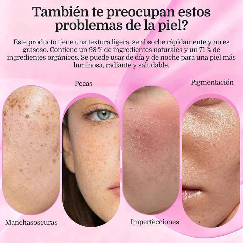 7.0 + TXA 4.0.CREAM Crema de manchas faciales