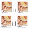 Dahua Cámara Endoscopio Wifi De Oídos, Otoscopio Con 6 Led's