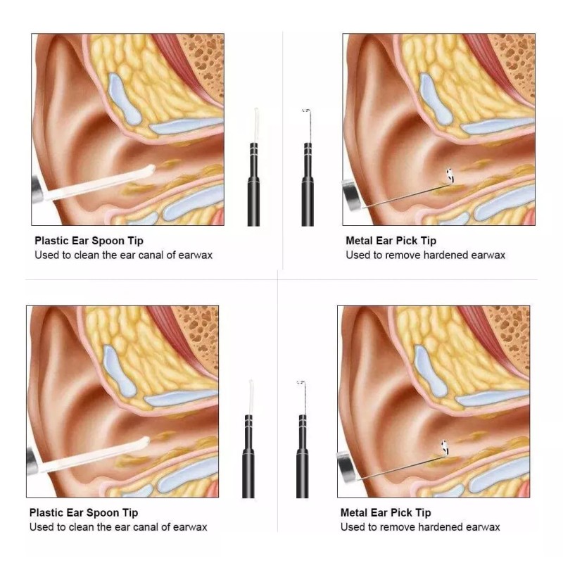 Dahua Cámara Endoscopio Wifi De Oídos, Otoscopio Con 6 Led's