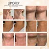 Neck Lifting Hydrating Firming Intense Treatment Bio - Cellulose Mask