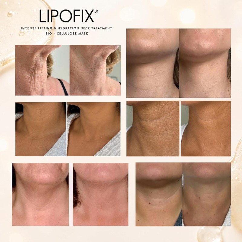 Neck Lifting Hydrating Firming Intense Treatment Bio - Cellulose Mask