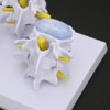 4-stage Medicals Human Lumbar Vertebrae Combination of Normal and Pathological