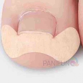 Funny ingrown toenail correction band 30pcs ingrown toenail care toe care toenail care Ingrown toenail band 30P 2ea