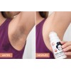 Kit Crema Facial Desodorante Aclarate Ácido Kójico Manchas