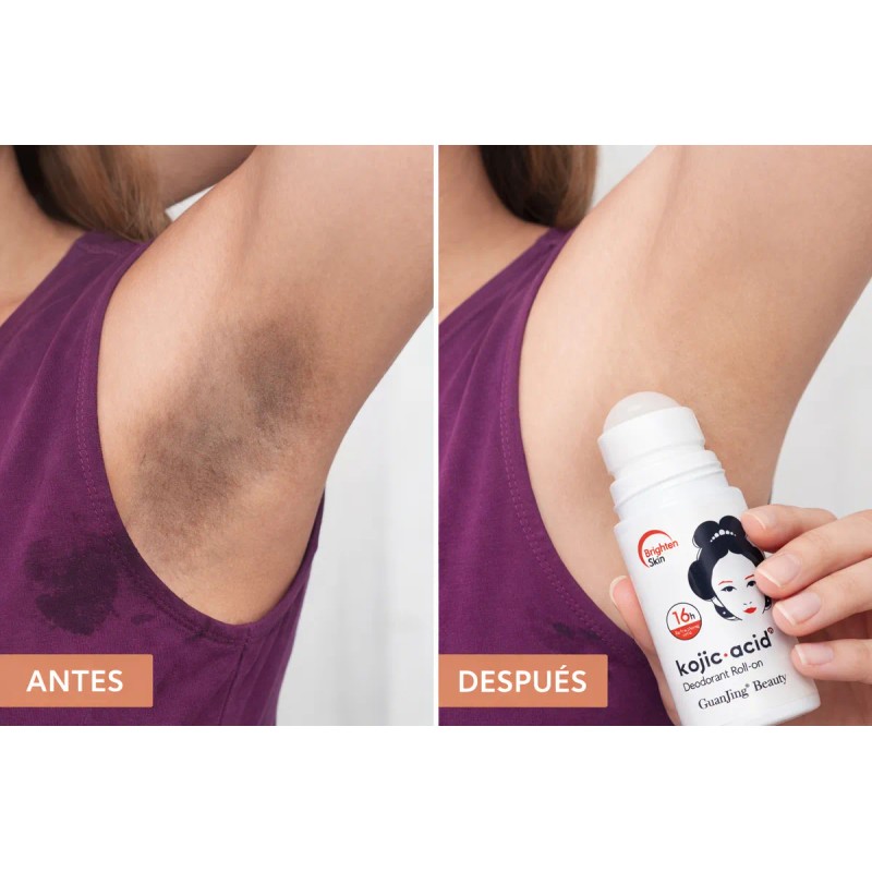 Kit Crema Facial Desodorante Aclarate Ácido Kójico Manchas