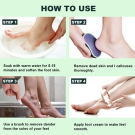 SIRALMNO Upgrade 2-in-1 Nano Glass Callus Remover,Foot scraper which used wet and Dry Callus Removal,Foot Rasp for Hard&dead Skin foot care,Safe & Portable foot file