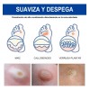 Sistema Verruga Elimina Plantar Comunes 30ml Neutra