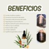 Aceite Capilar Ozonizado Romero Anti-caída de Cabello (30 ML)