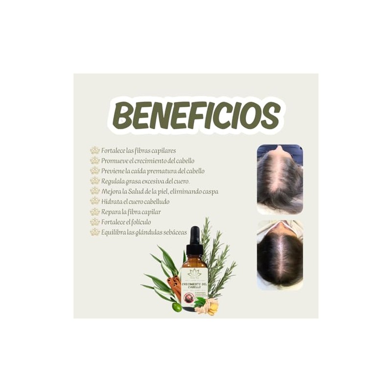 Aceite Capilar Ozonizado Romero Anti-caída de Cabello (30 ML)