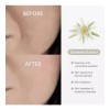 Dr. Althea Ceramidas: Hidratación Para Piel Sensible Juego3