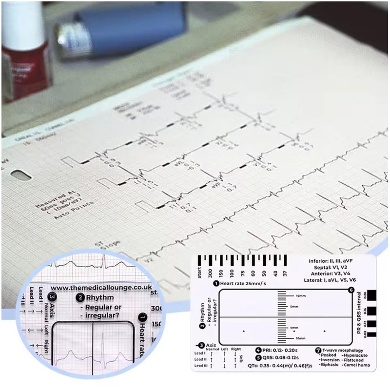 ECG 7 Step Ruler