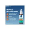 Nivea Derma Skin Clear Serum Anti-imperfecciones 30ml