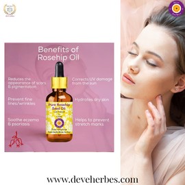 Deve Herbes Pure Rosehip Oil (Rosa rubiginosa) Cold Pressed 300ml (10 oz)
