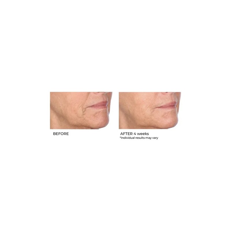 Suero De Biopéptido De Niacinamida Nassifmd Skincare