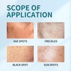 Freckle Remover Cream,Dark Age Spot Remover,Spot Cream Dark Spot Corrector,Reduce