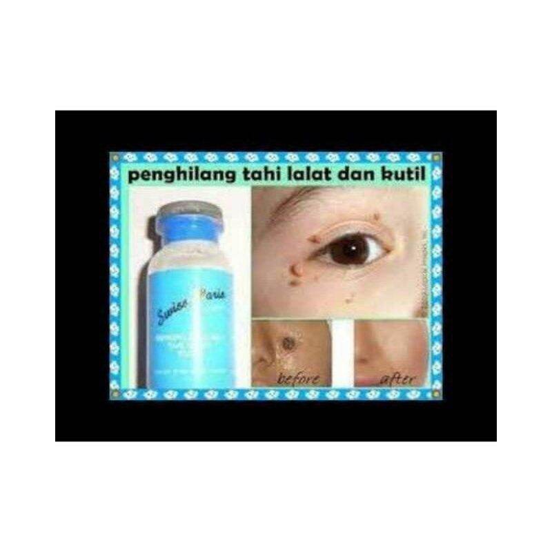 ( READY STOCK ) Swiss paris lotion penghilang kutil tahi