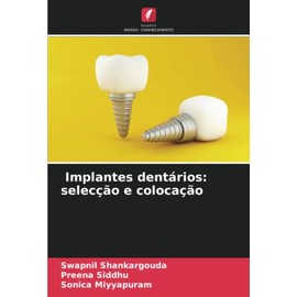 Implantes dentários: selecção e colocação