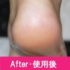 PERFECT NAILS Foot File, Foot Care, File, Waterproof, Exfoliating, Exfoliating,