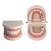 Dental Caries Study Tool Adult Standard Typodont Demonstration Teeth Model
