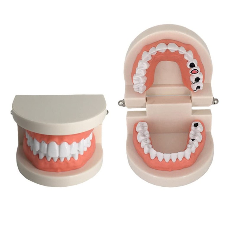 Dental Caries Study Tool Adult Standard Typodont Demonstration Teeth Model