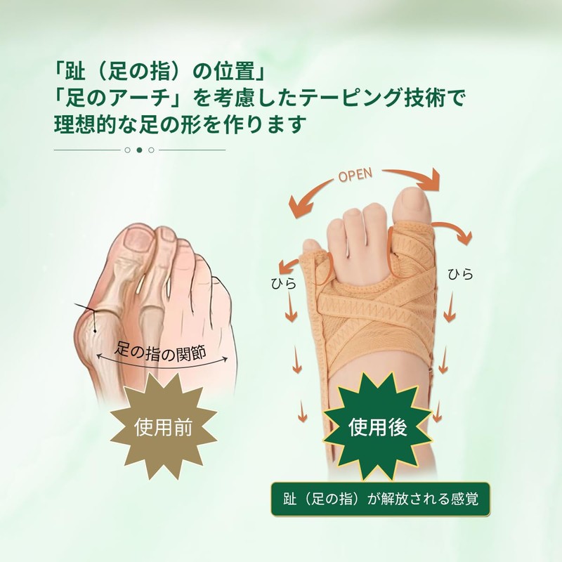 Srarosai Toe Supporter, Big Toe/Little Toe Supporter, Bunion Countermeasure, Thin,