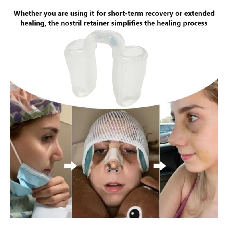 Kit Férula Doyle Nasales Médica Termoplásticas Rinoplastia